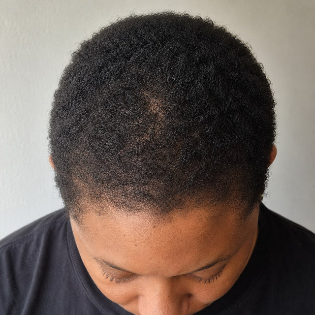 Illustrative simulation: coils filled in at the edges and crown after months of use