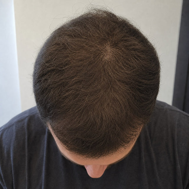 Illustrative simulation: fuller crown after months of use