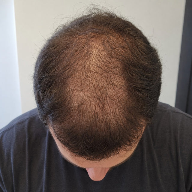 Illustrative simulation: thinning crown before use